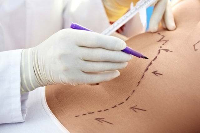 lipoaspiração à laser em Jacarei