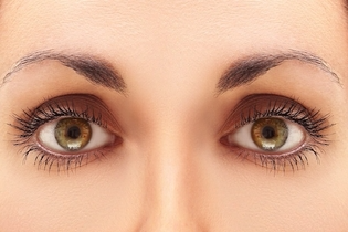 Cirurgia das pálpebras (blefaroplastia) em Jacareí-Depois da cirurgia