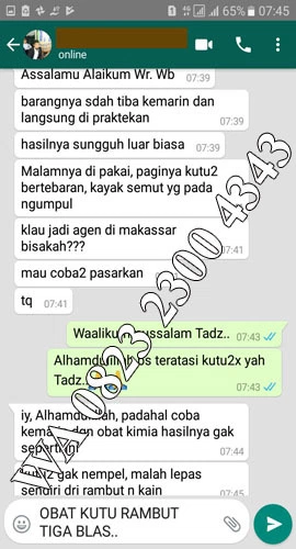 cara menghilangkan kutu rambut cara menghilangkan kutu rambut